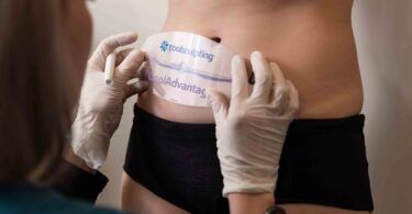 Facts About CoolSculpting: What You Need to Know