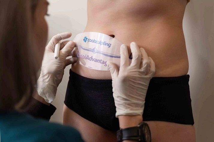 Facts About CoolSculpting: What You Need to Know