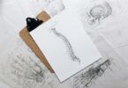 Can I Dance with Scoliosis? Embrace the Pole with Confidence
