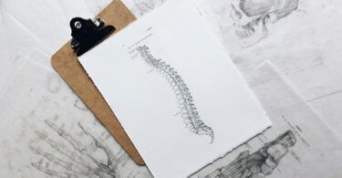 Can I Dance with Scoliosis? Embrace the Pole with Confidence