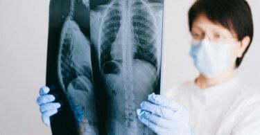 Lung Cancer Specialist Singapore: Expert Care for Better Outcomes