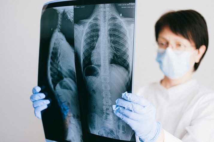 Lung Cancer Specialist Singapore: Expert Care for Better Outcomes