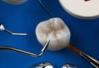 Dental Drill With Stoppers Set: Should You Use ø2.8 or Ø3.65?