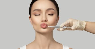 lip injection benefit Achieve Fuller, Natural Lips