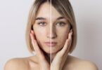 Does Vitamin C Treat Melasma? Benefits & Effectiveness Explained