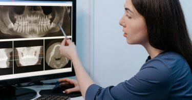 Top Reasons for Jawbone Deterioration and How to Address Them