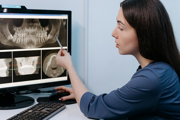 Top Reasons for Jawbone Deterioration and How to Address Them