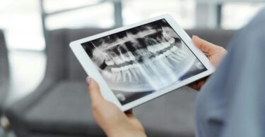 Benefits of Orthodontic Treatment: Why It’s More Than Just a Great Smile