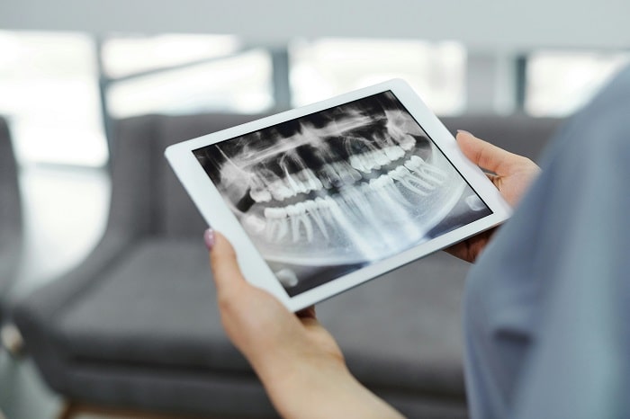 Benefits of Orthodontic Treatment: Why It’s More Than Just a Great Smile