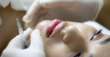 Med Supply Solutions: Buy Premium Dermal Fillers Wholesale