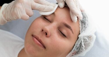 Affordable Pigmentation Clinics in Singapore - Expert Guide