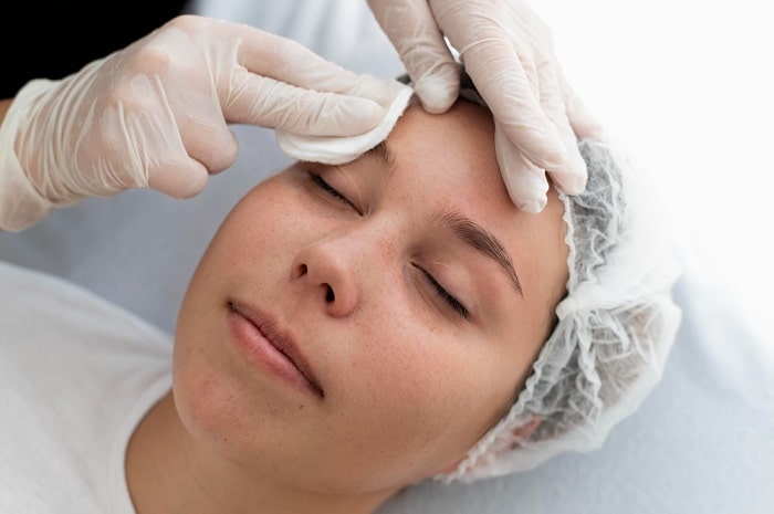 Affordable Pigmentation Clinics in Singapore - Expert Guide