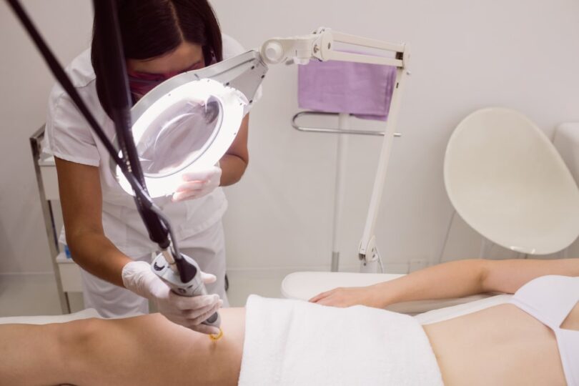 When Is the Best Time to Start Laser Hair Removal?