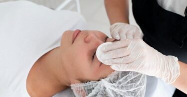 Pigmentation Clinic Singapore