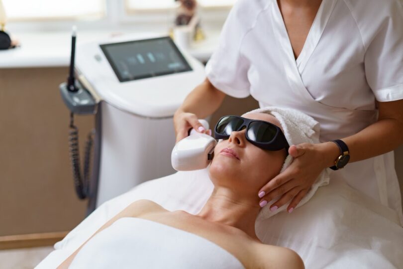 Acne Laser Treatment: Are the Results Permanent? 