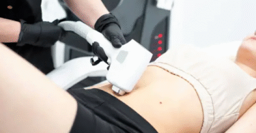 Laser Lipo vs. Traditional Fat Reduction