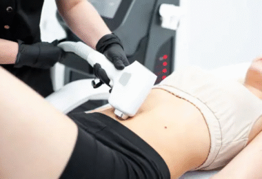 Laser Lipo vs. Traditional Fat Reduction